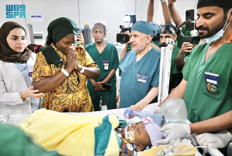 Saudi team separates Tanzanian conjoined twins after 16-hour surgery